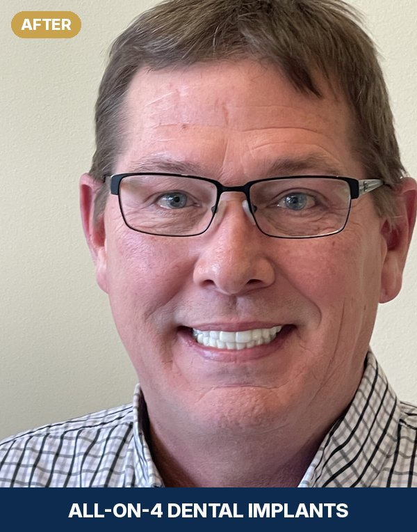 Bobby after All-on-4 dental implants at New Image Dentistry in Franklin, TN